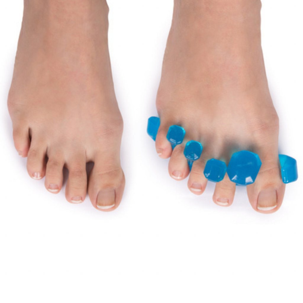 Rozdiel pred a po použití separátora prstov na nohe blue briliat